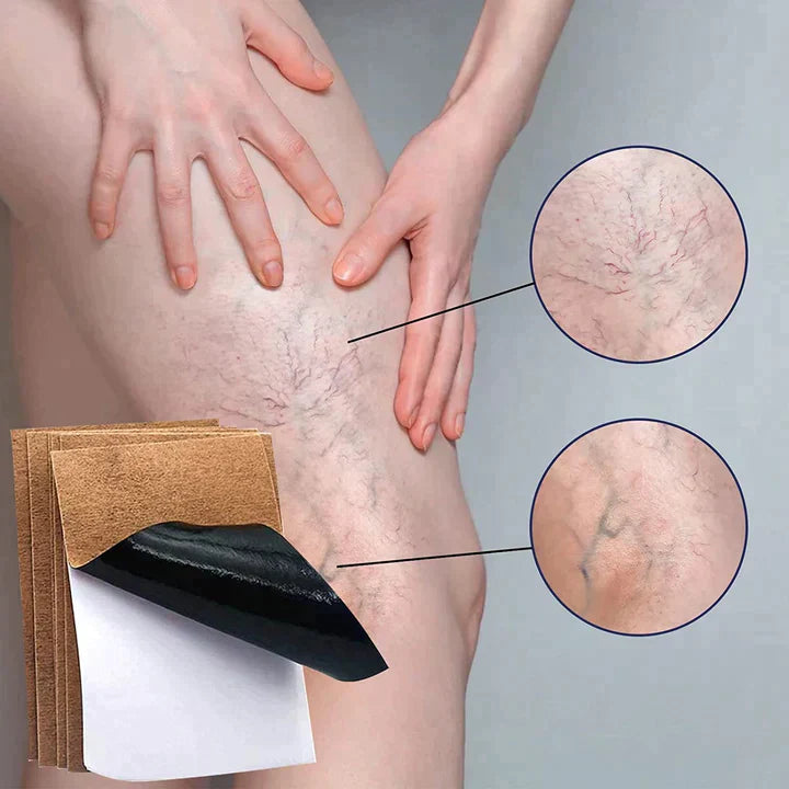 Varipro™ - Parche para Varices ( PACK 10 UNIDADES ) 🎁SOLO POR HOY PACK 2X1🎁
