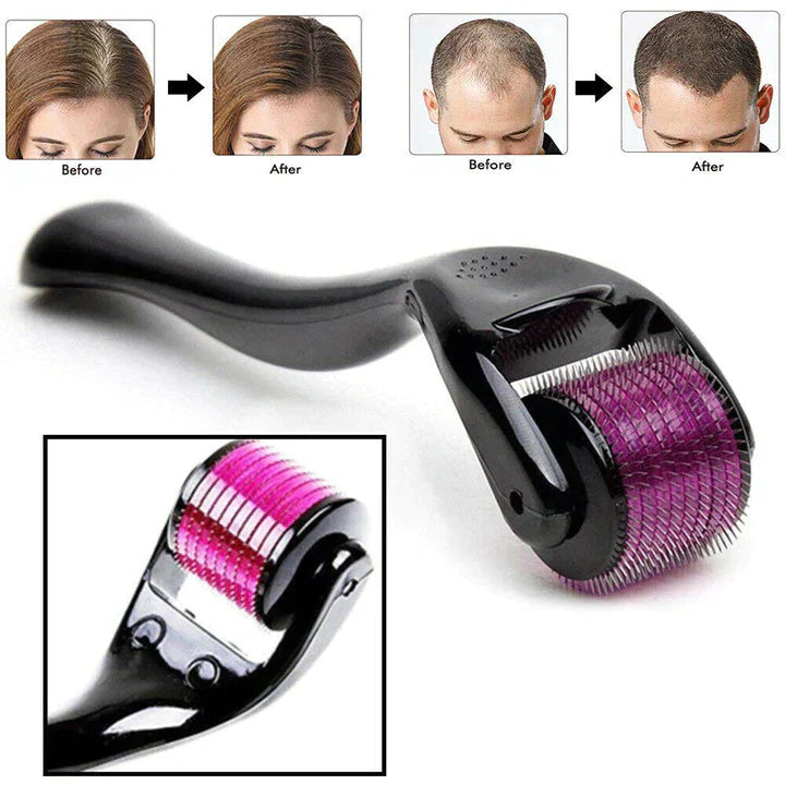 Derma Roller - Rodillo Estimulador Crecimiento