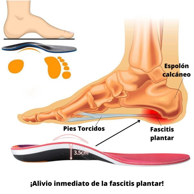 Plantillas Ortopédicas ¡Oferta Exclusiva de Abril!