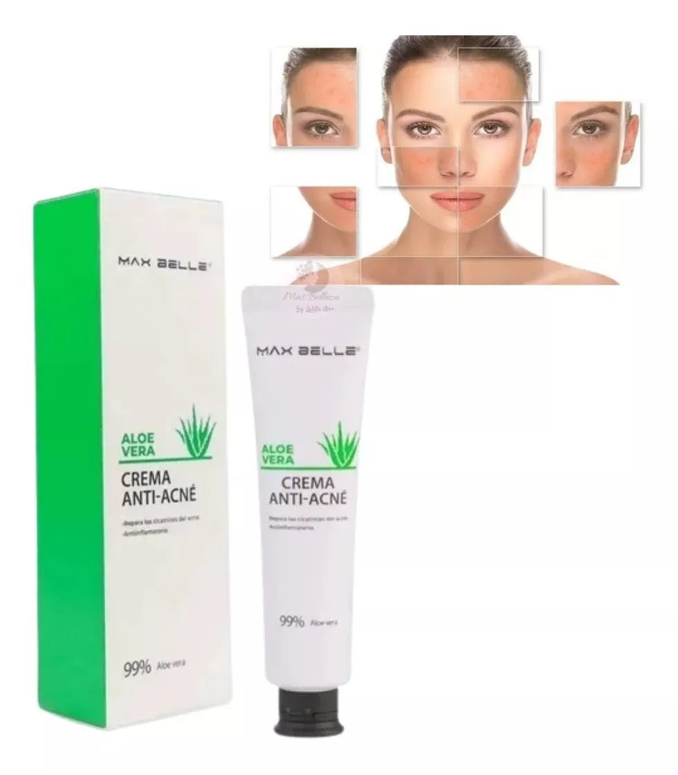 Crema Anti-acne De Aloe Vera (Compra 1 y Obtén 1 GRATIS!)