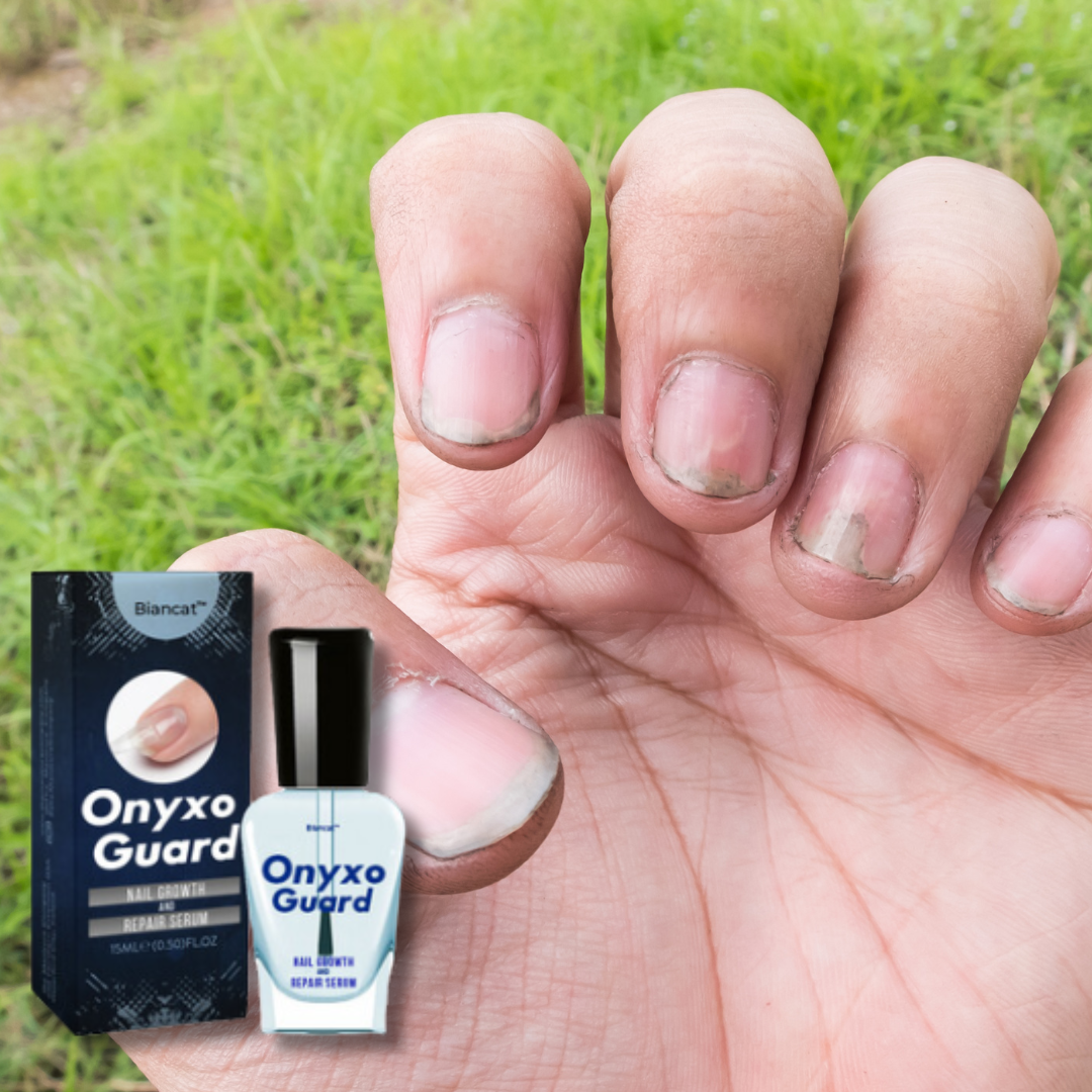 ONYXOGUARD ®️ UÑAS FUERTES EN HORAS 💅 SOLO POR HOY 2x1 🎁