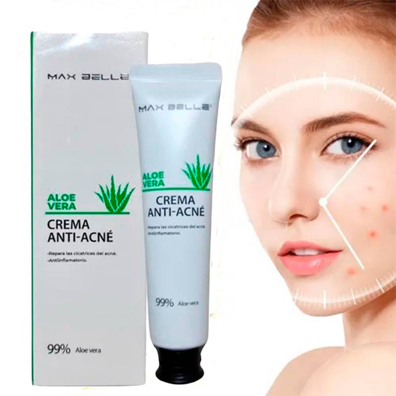 Crema Anti-acne De Aloe Vera (Compra 1 y Obtén 1 GRATIS!)
