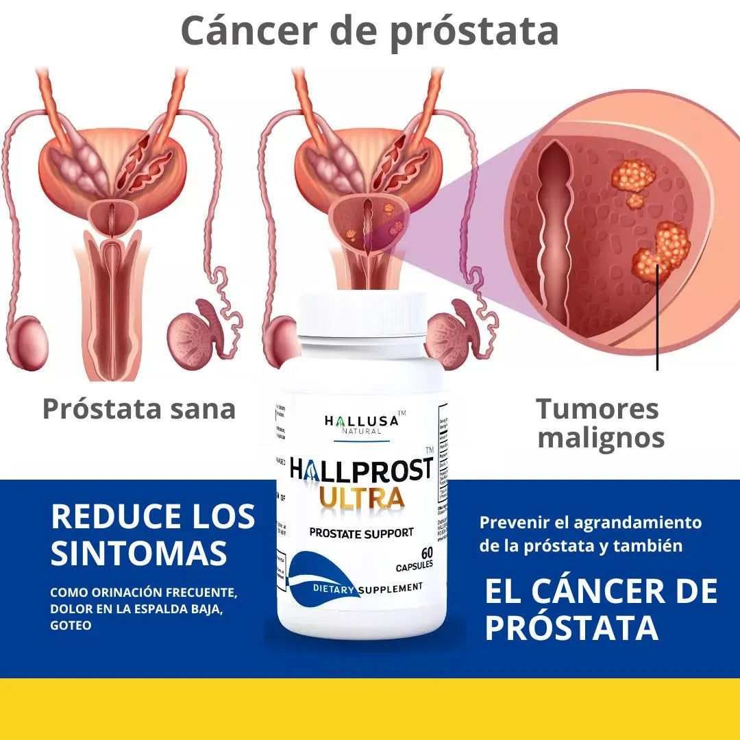 HALLPROST ULTRA 🔥 Últimas unidades🔥