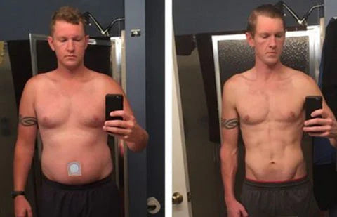 BBOJI™ GLP-1 Patches – Fast Results for a Slimmer, Healthier You