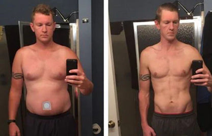 BBOJI™ GLP-1 Patches – Fast Results for a Slimmer, Healthier You
