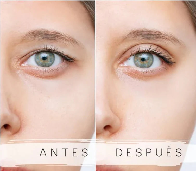 2X1😍🎁Disminuye el 80% del efecto párpado caído al instante - Realza Tus Párpados Caídos