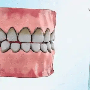 Limpiador Dental Ultrasónico