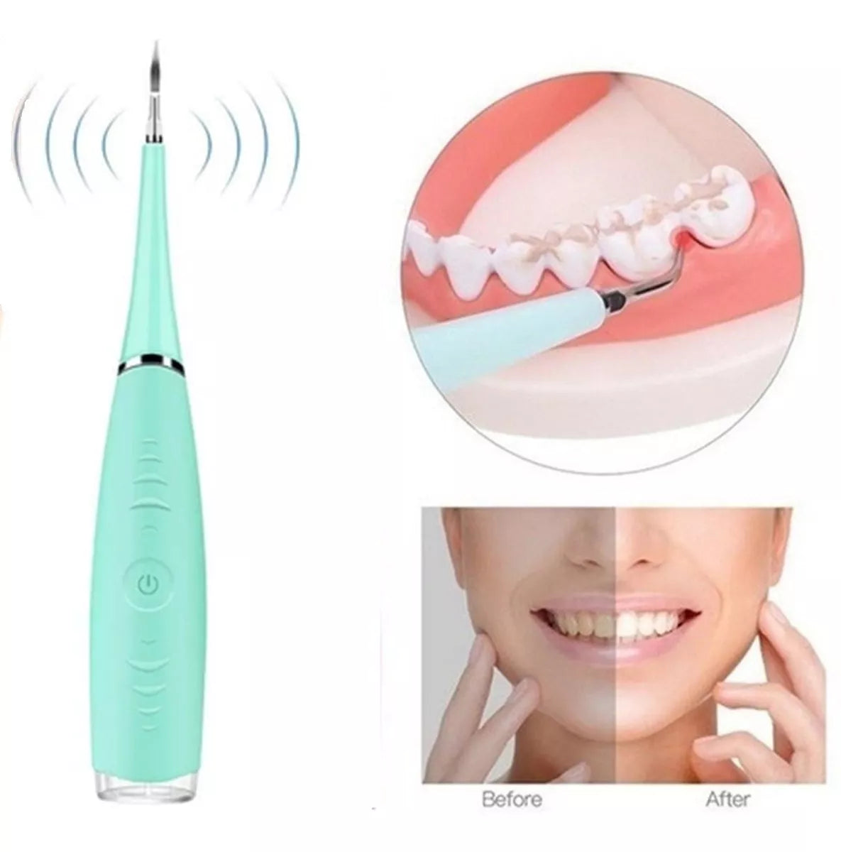 Limpiador Dental Ultrasónico