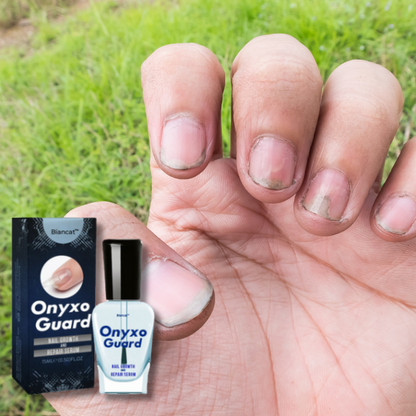 ONYXOGUARD ®️ UÑAS FUERTES EN HORAS 💅 SOLO POR HOY 2x1  🎁