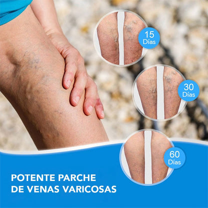 Parches Anti Varices, Flebitis Y Vasculitis