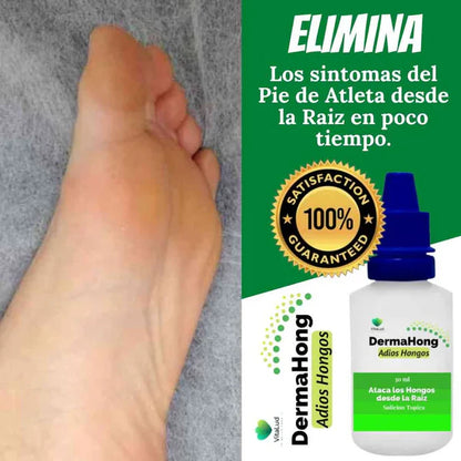 2 X 1 - DermaHong Pro™ – Dile Adiós a los Hongos disminuye en 15 Días 🔥 Producto en tendencia